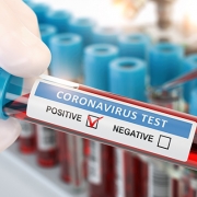 Coronavirus Test Positive