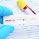 Test for Coronavirus
