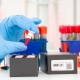 COVID Antibody Test