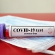 Antibody Covid Test