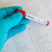 measles