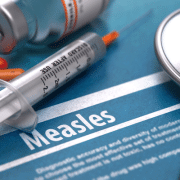 measles