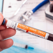 measles