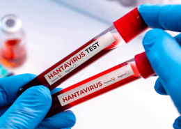 hanta virus