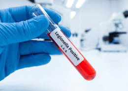Legionnaires Disease