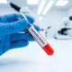 Legionnaires Disease