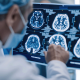 parkinsons